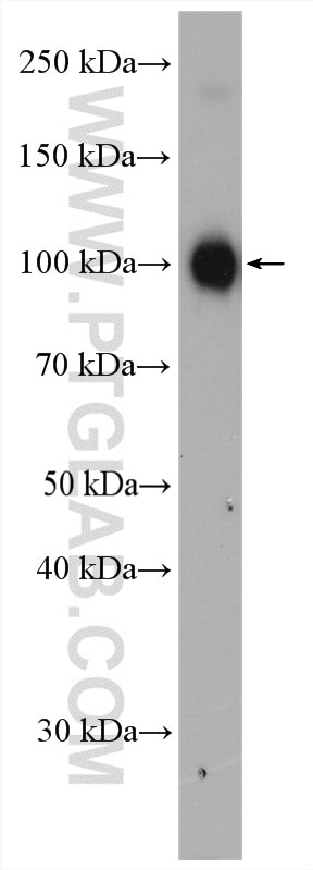 Western Blot (WB) analysis of mouse spleen tissue using Cd68 Polyclonal antibody (28058-1-AP)