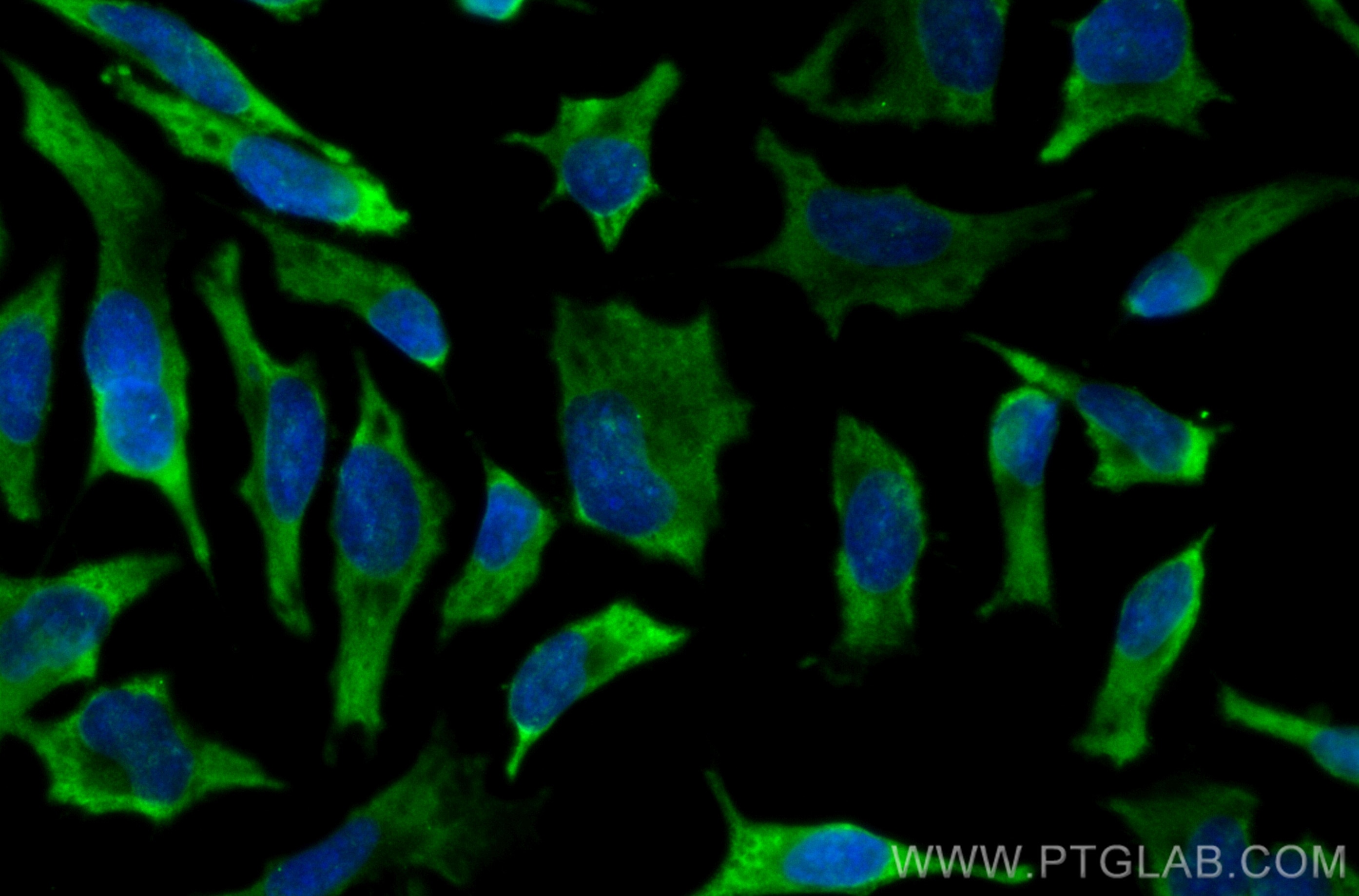 Immunofluorescence (IF) / fluorescent staining of HeLa cells using CoraLite® Plus 488-conjugated Cdc20 Polyclonal ant (CL488-10252)