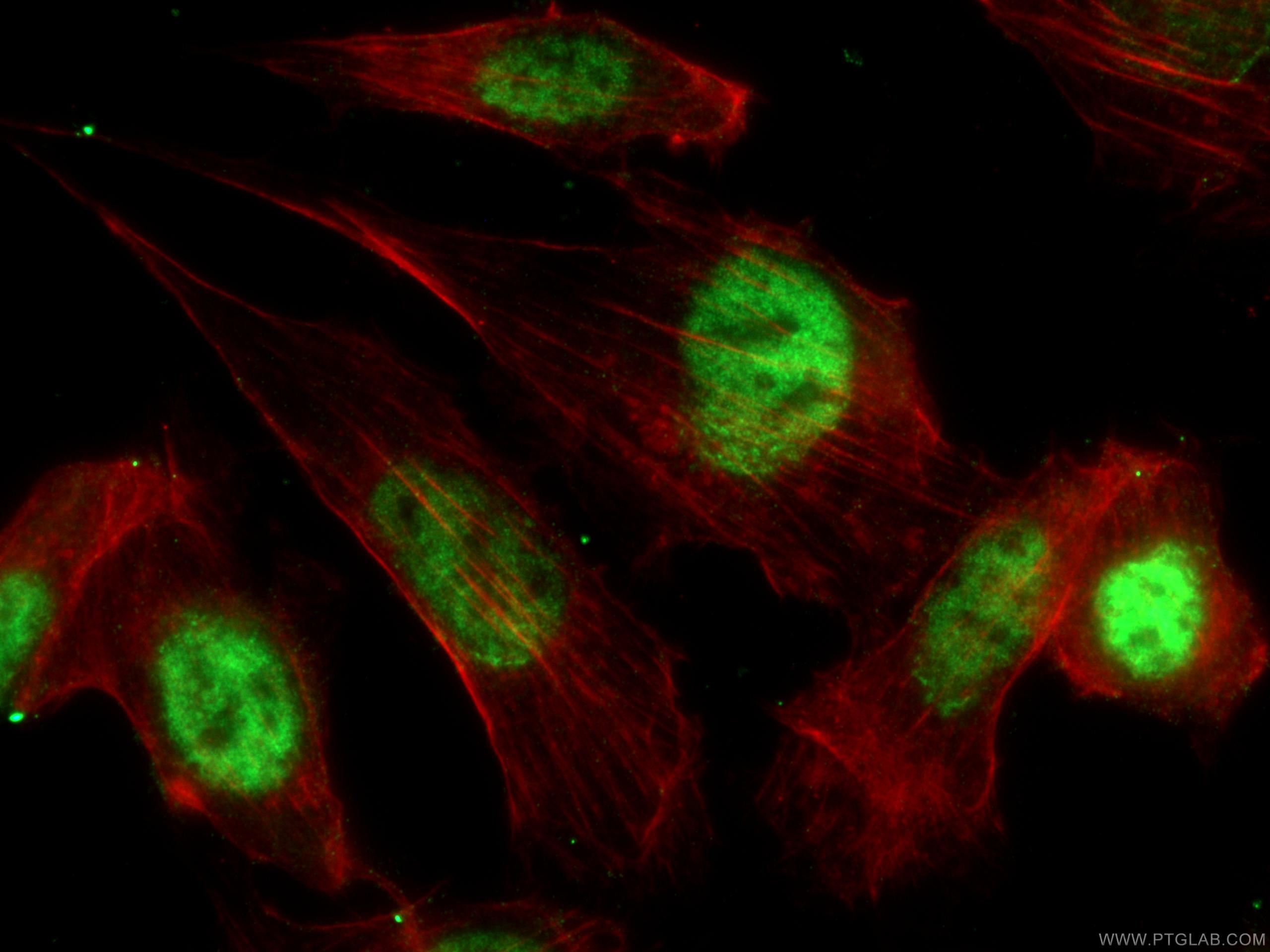 Immunofluorescence (IF) / fluorescent staining of NIH/3T3 cells using p21 Polyclonal antibody (28248-1-AP)