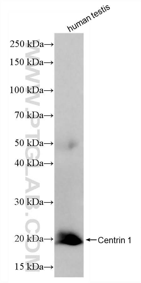 Human testis tissue was subjected to SDS PAGE followed by western blot with 85637-2-RR (CETN1 antibody) at dilution of 1:1000 incubated at room temperature for 1.5 hours. This data was developed using the same antibody clone with 85637-2-PBS in a different storage buffer formulation. Western Blot (WB) analysis of various lysates using Centrin 1 Recombinant monoclonal antibody (85637-2-RR)