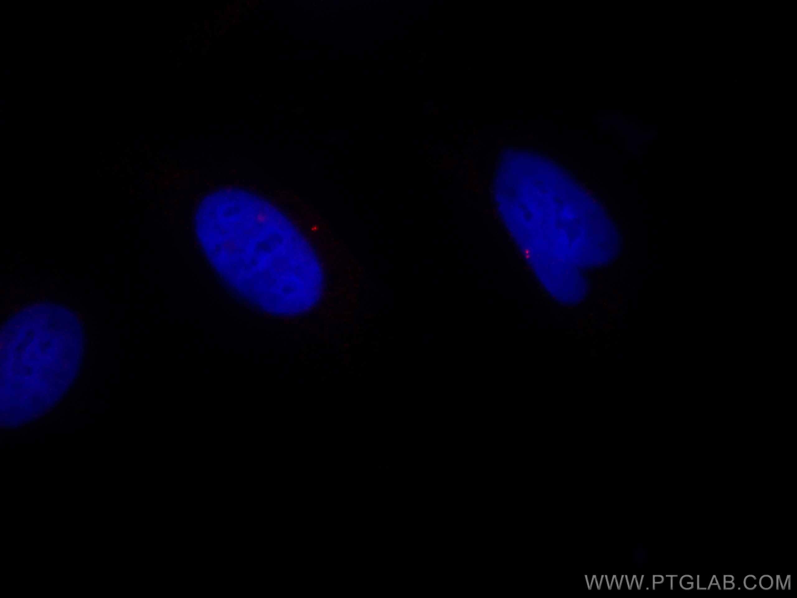 Immunofluorescence (IF) / fluorescent staining of HeLa cells using CoraLite®594-conjugated Centrin 1 Polyclonal antib (CL594-12794)