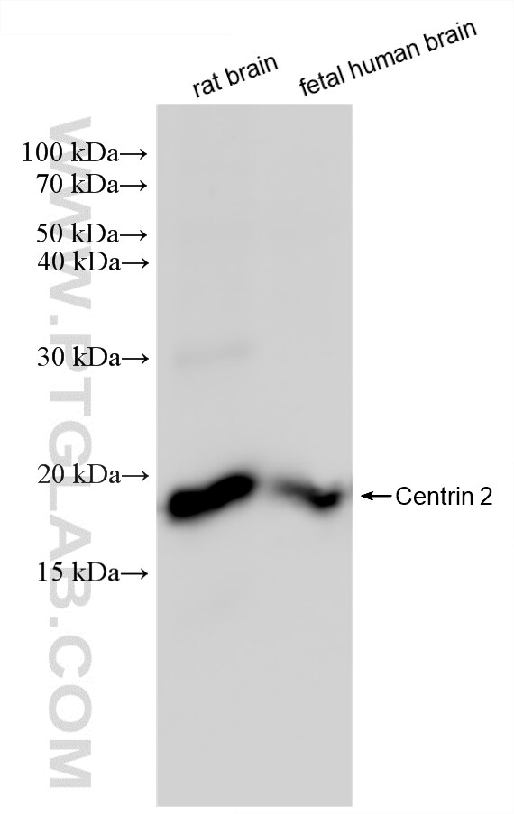 WB analysis using 88406-1-RR Western Blot (WB) analysis of various lysates using Centrin 2 Recombinant monoclonal antibody (88406-1-RR)