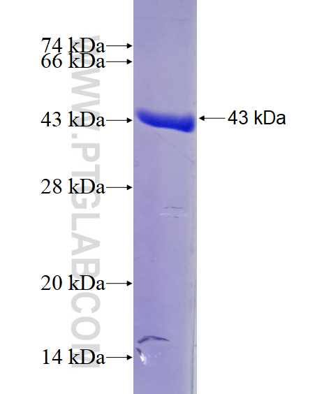 Centrin 2 fusion protein Ag8638 SDS-PAGE
