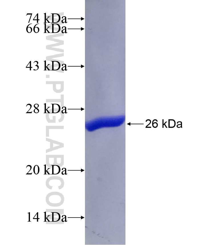 Centromere protein R fusion protein Ag18033 SDS-PAGE