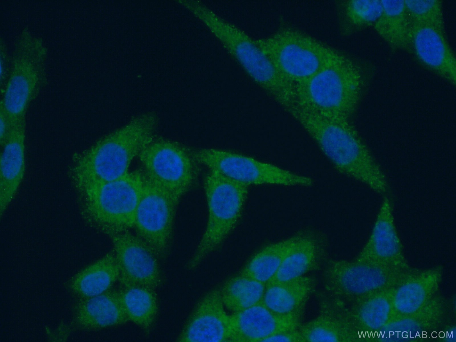 Immunofluorescence (IF) / fluorescent staining of HeLa cells using Ch-TOG Polyclonal antibody (26457-1-AP)
