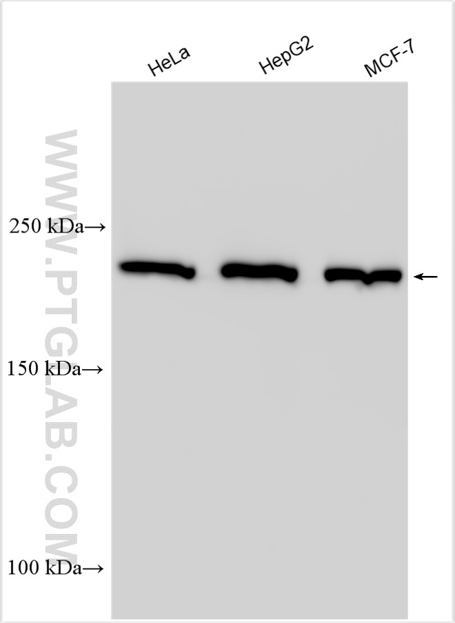 Western Blot (WB) analysis of various lysates using Ch-TOG Polyclonal antibody (26457-1-AP)