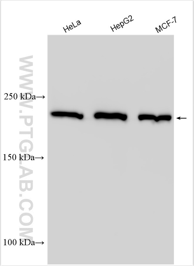 Western Blot (WB) analysis of various lysates using Ch-TOG Polyclonal antibody (26457-1-AP)