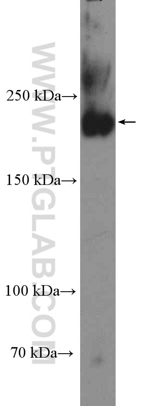 Western Blot (WB) analysis of NCCIT cells using Ch-TOG Polyclonal antibody (26457-1-AP)