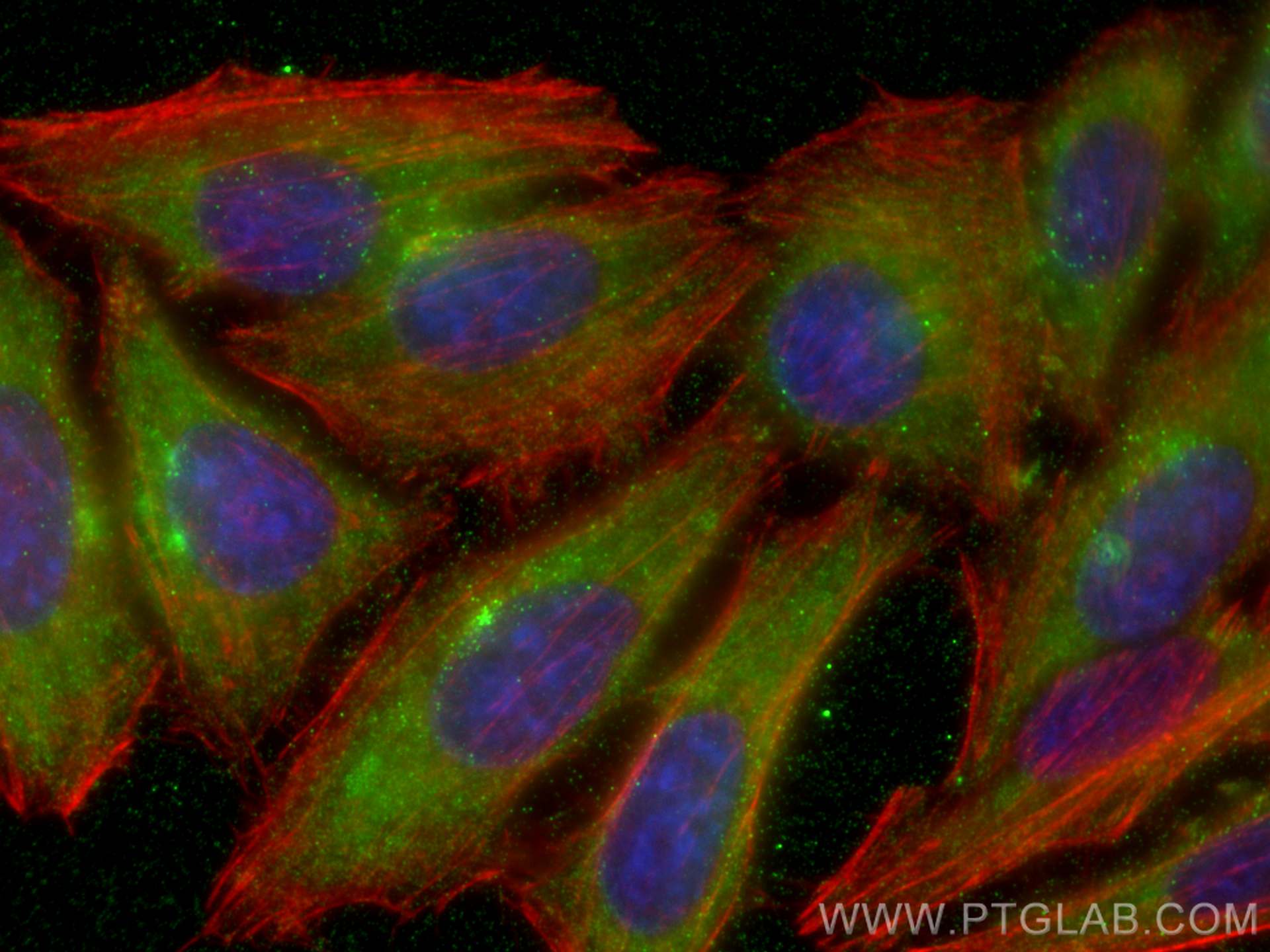 Immunofluorescence (IF) / fluorescent staining of HepG2 cells using Ch-TOG Monoclonal antibody (67631-1-Ig)