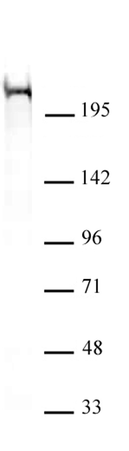 Chd5 antibody (mAb) (Clone 5A10) tested by Western blot. Chd5 antibody detection by Western blot. The analysis was performed using 40 ug of HeLa nuclear extract and Chd5 antibody at a 2 ug/ml dilution.