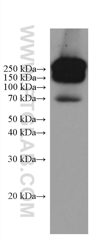 WB analysis of Recombinant protein using 67405-1-Ig