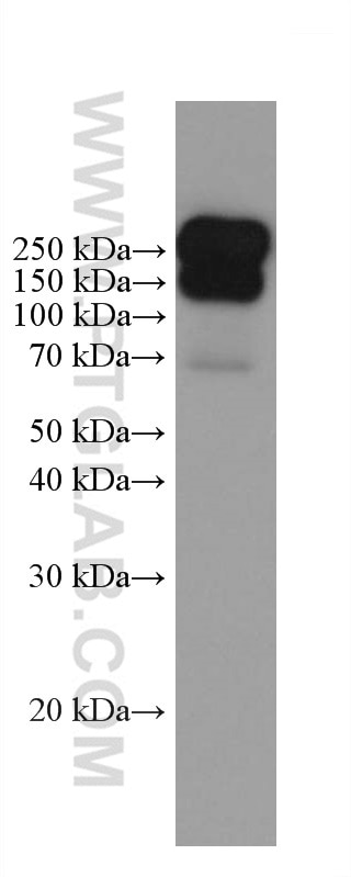 WB analysis of Recombinant protein using 67405-1-Ig