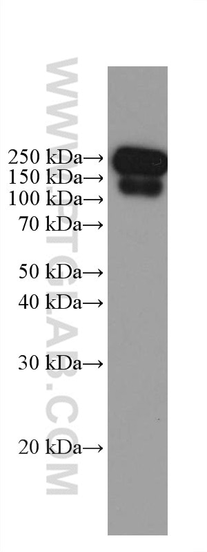 Western Blot (WB) analysis of Recombinant protein using Chicken IgY Monoclonal antibody (67405-1-Ig)