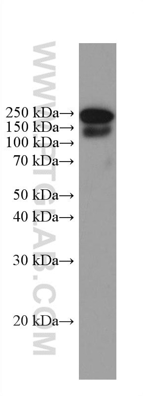 Western Blot (WB) analysis of Recombinant protein using Chicken IgY Monoclonal antibody (67405-1-Ig)