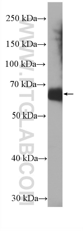 Western Blot (WB) analysis of Recombinant protein using HRP-conjugated Chicken IgY Monoclonal antibody (HRP-67405)