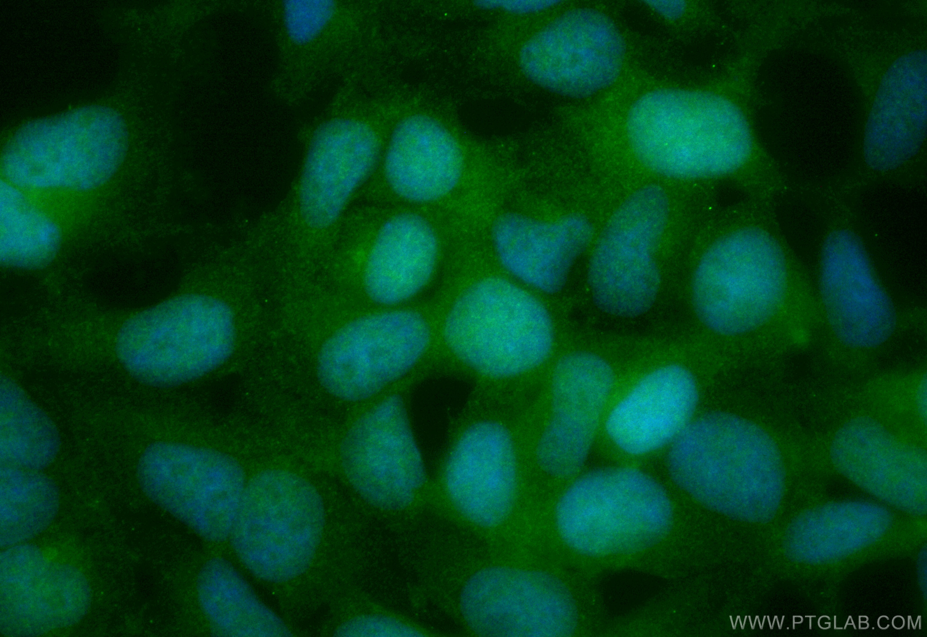 Immunofluorescence (IF) / fluorescent staining of HEK-293 cells using CoraLite® Plus 488-conjugated Chk1 Recombinant ant (CL488-84905)