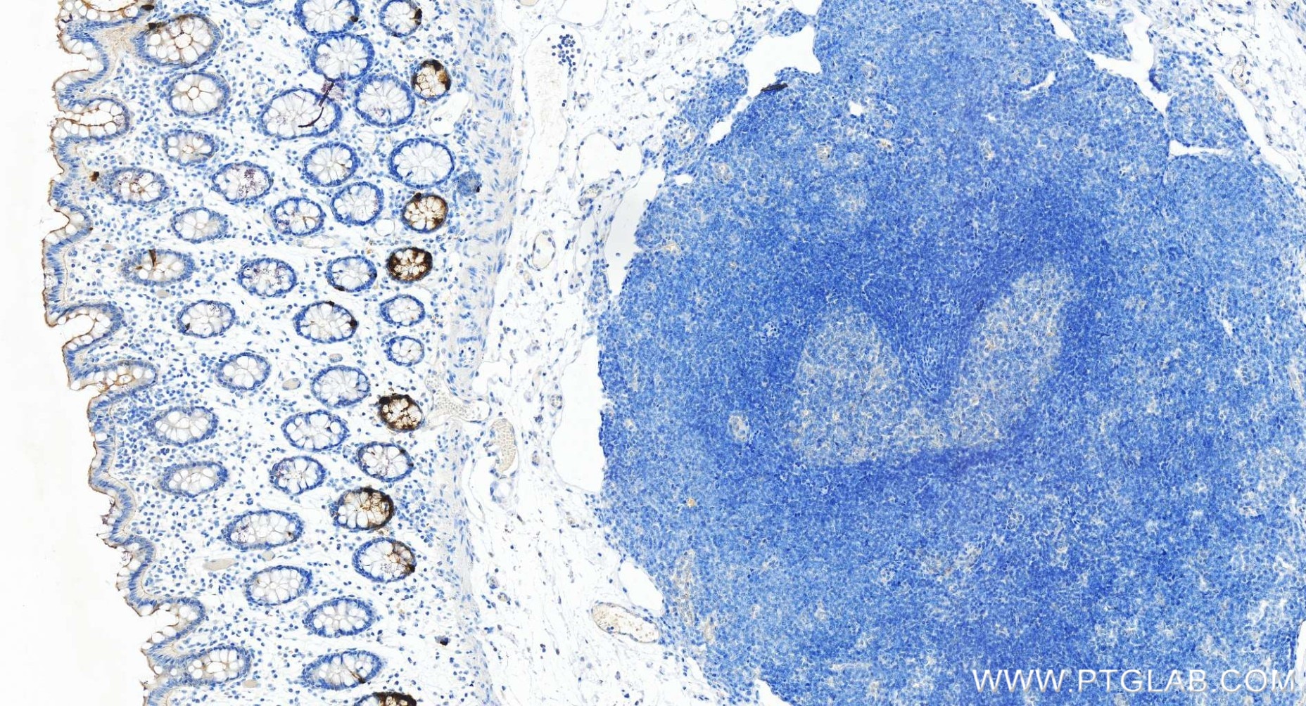 Immunohistochemistry (IHC) staining of human colon tissue using Chromogranin A Recombinant antibody (85605-2-RR)