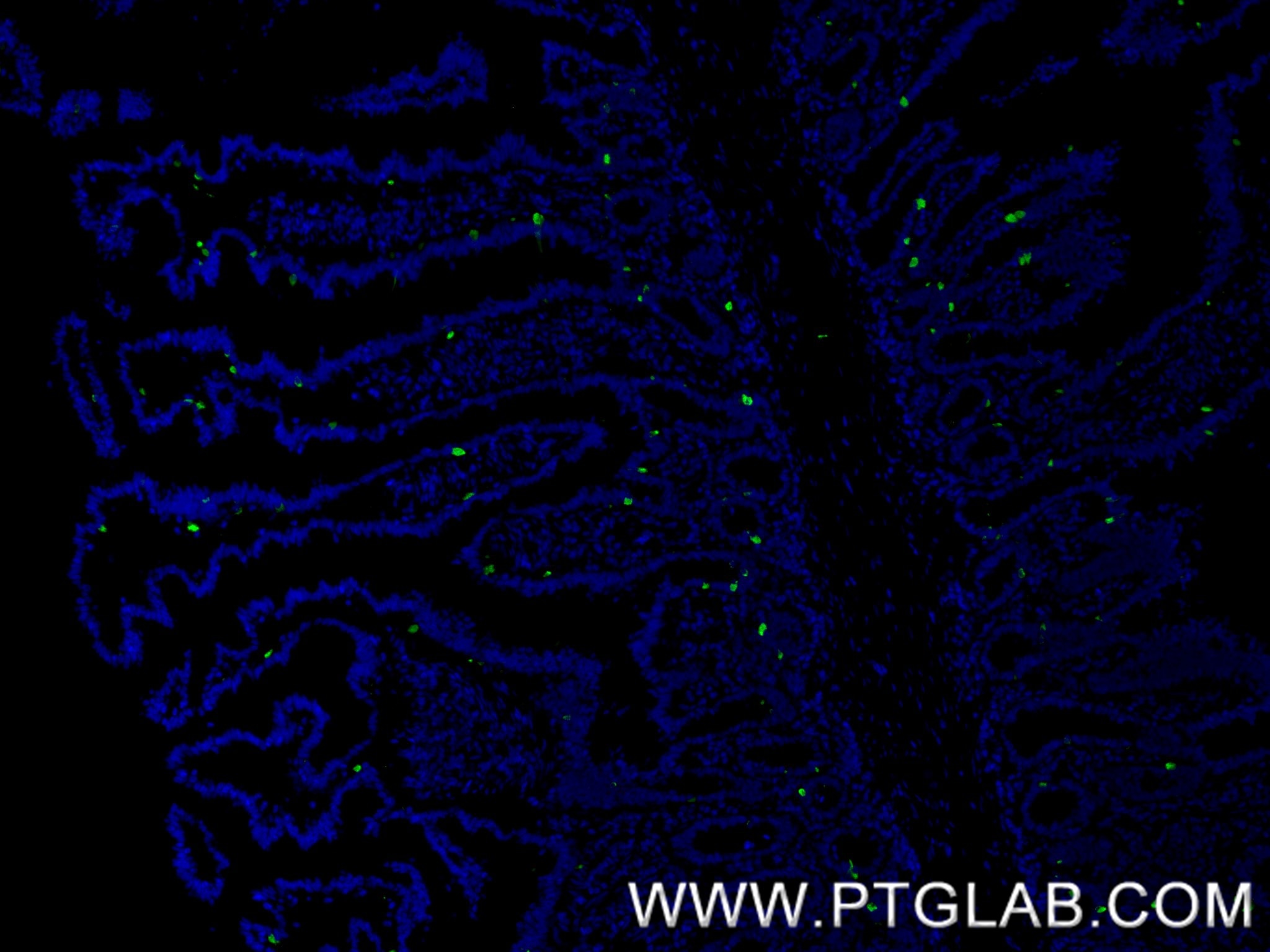 IF Staining of human small intestine using 85605-2-RR Immunofluorescence (IF) / fluorescent staining of human small intestine tissue using Chromogranin A Recombinant monoclonal antibody (85605-2-RR)