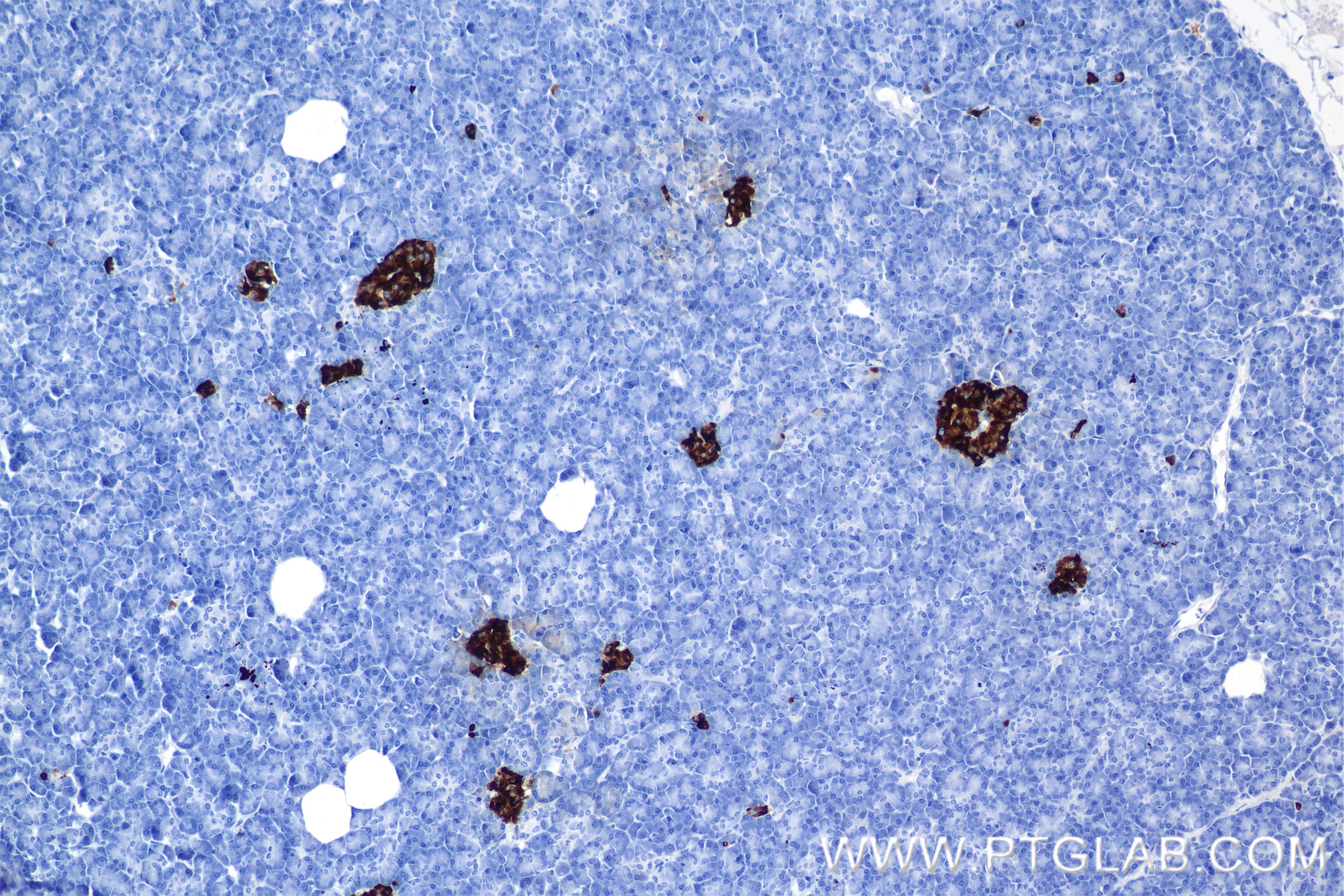 Immunohistochemistry (IHC) staining of human pancreas tissue using Chromogranin A Recombinant antibody (85605-2-RR)