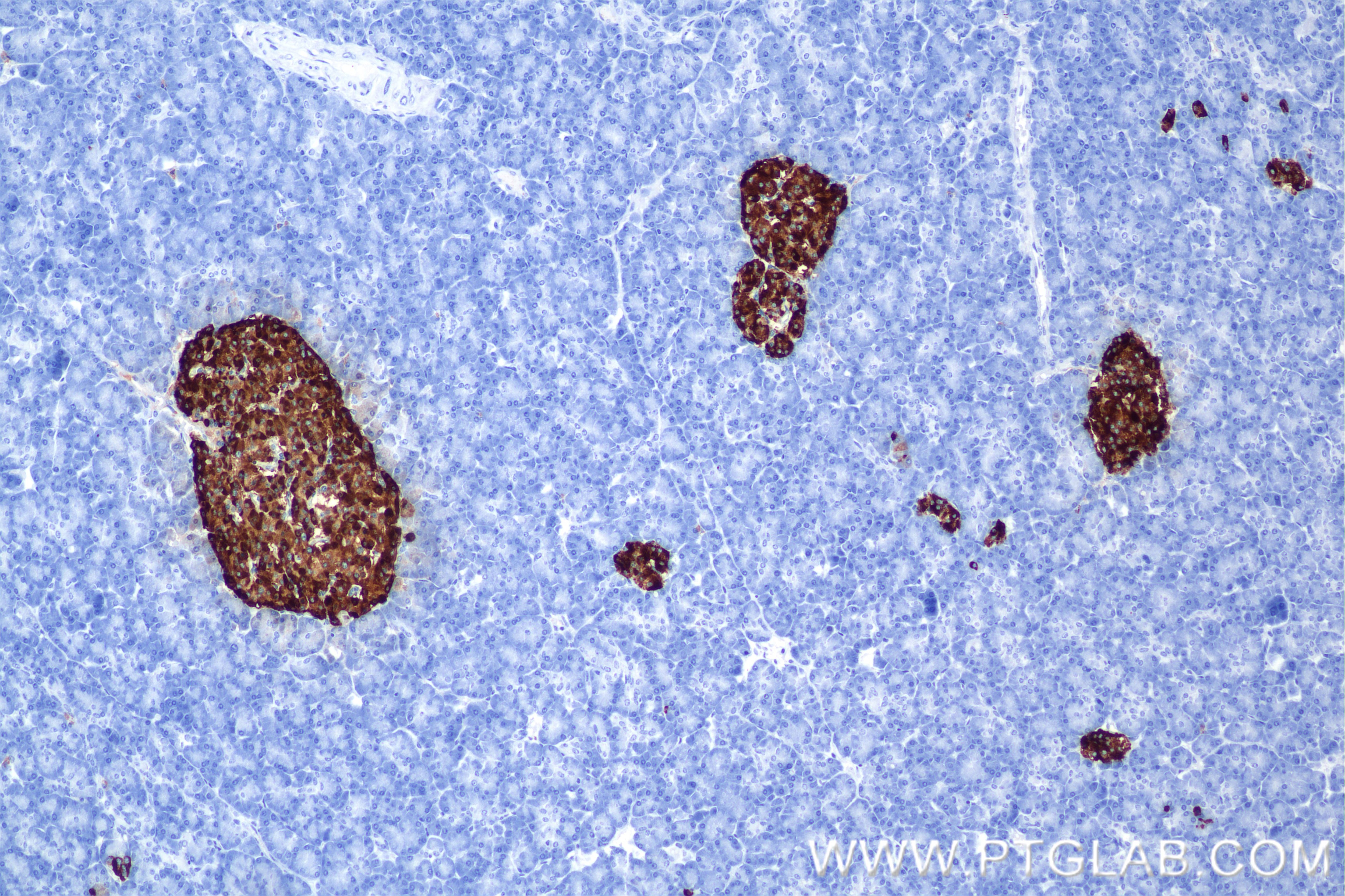 Immunohistochemical analysis of paraffin-embedded human pancreas tissue slide using 85605-2-RR (Chromogranin A antibody) at dilution of 1:2000 (under 10x lens). Heat mediated antigen retrieval with Tris-EDTA buffer (pH 9.0). This data was developed using the same antibody clone with 85605-2-PBS in a different storage buffer formulation. Immunohistochemistry (IHC) staining of human pancreas tissue using Chromogranin A Recombinant monoclonal antibody (85605-2-RR)