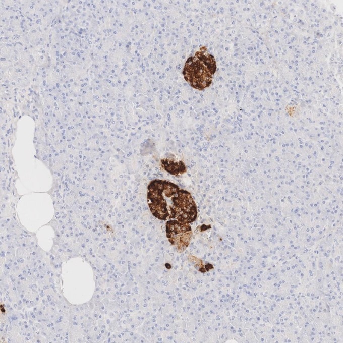 IHC staining of human pancreas using 85605-2-RR Immunohistochemistry (IHC) staining of human pancreas tissue using Chromogranin A Recombinant monoclonal antibody (85605-2-RR)