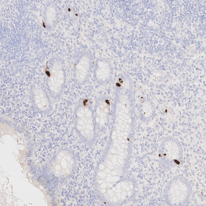 IHC staining of human appendicitis using 85605-2-RR Immunohistochemistry (IHC) staining of human appendicitis tissue using Chromogranin A Recombinant monoclonal antibody (85605-2-RR)
