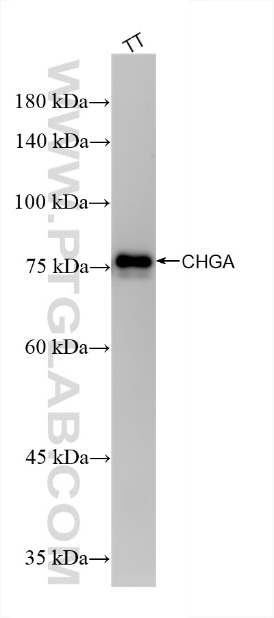 Western Blot (WB) analysis of various lysates using Chromogranin A Recombinant antibody (85605-2-RR)