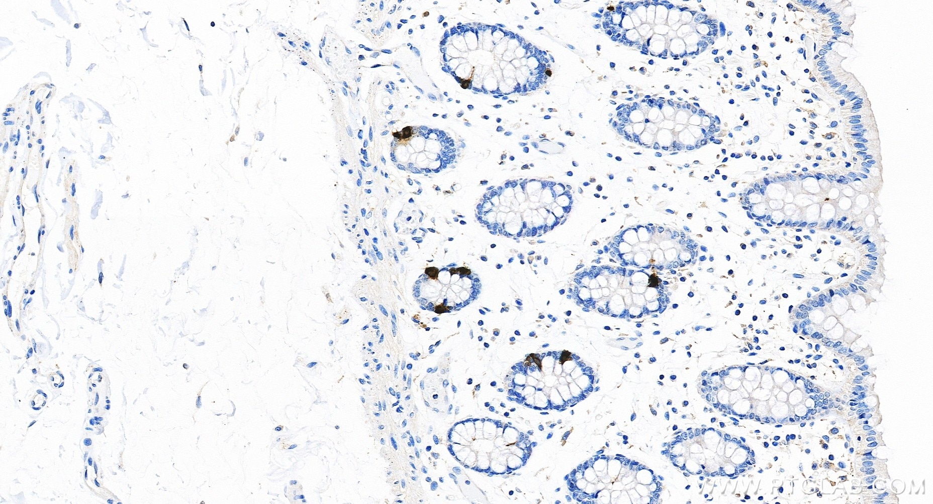 Immunohistochemistry (IHC) staining of human colon tissue using Anti-Human Chromogranin A Rabbit Recombinant Antib (98570-1-RR)