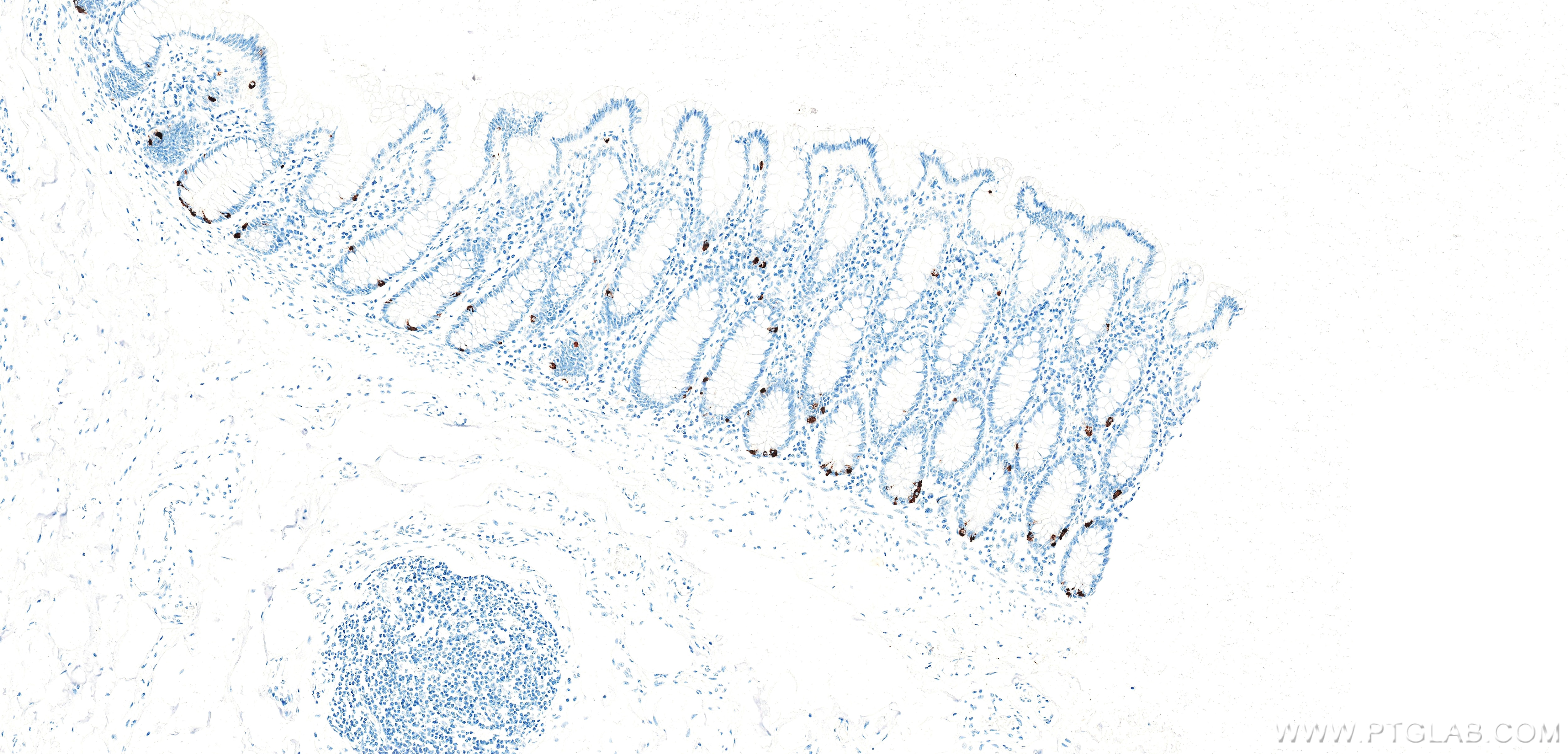 Immunohistochemistry (IHC) staining of human colon tissue using Anti-Human Chromogranin A Rabbit Recombinant Antib (98570-1-RR)