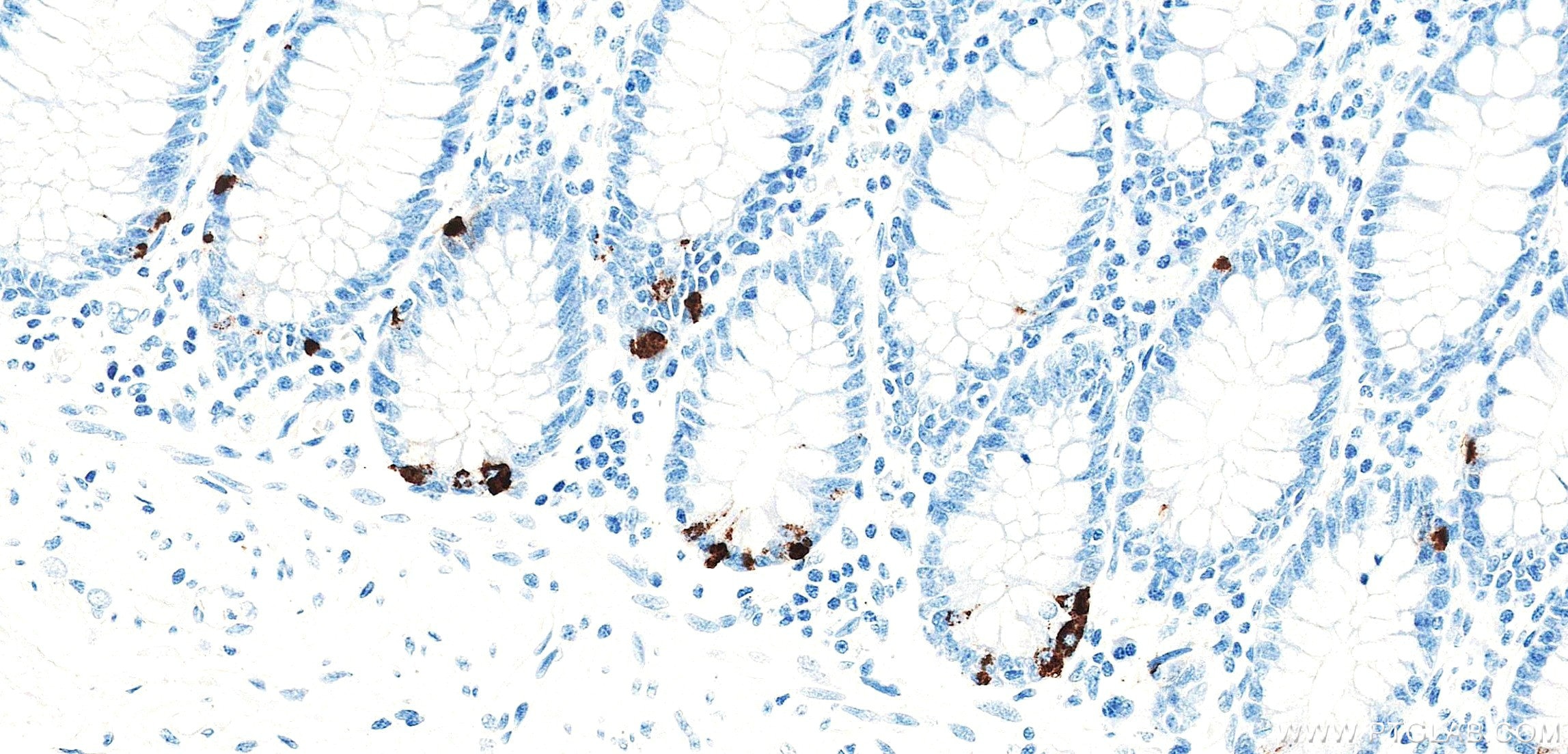 Immunohistochemistry (IHC) staining of human colon tissue using Anti-Human Chromogranin A Rabbit Recombinant Antib (98570-1-RR)