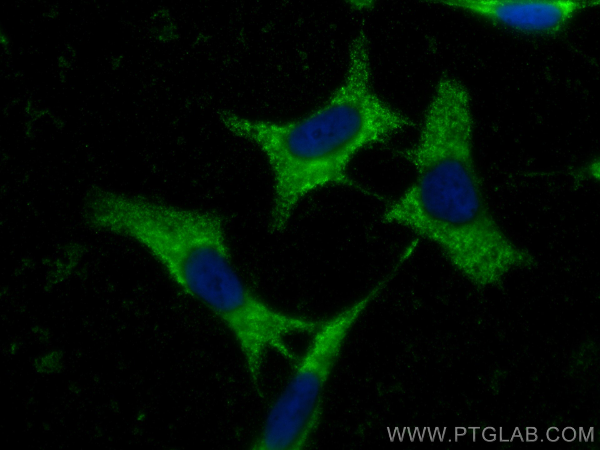 Immunofluorescence (IF) / fluorescent staining of SH-SY5Y cells using CoraLite® Plus 488-conjugated Chromogranin A Monoc (CL488-60135)