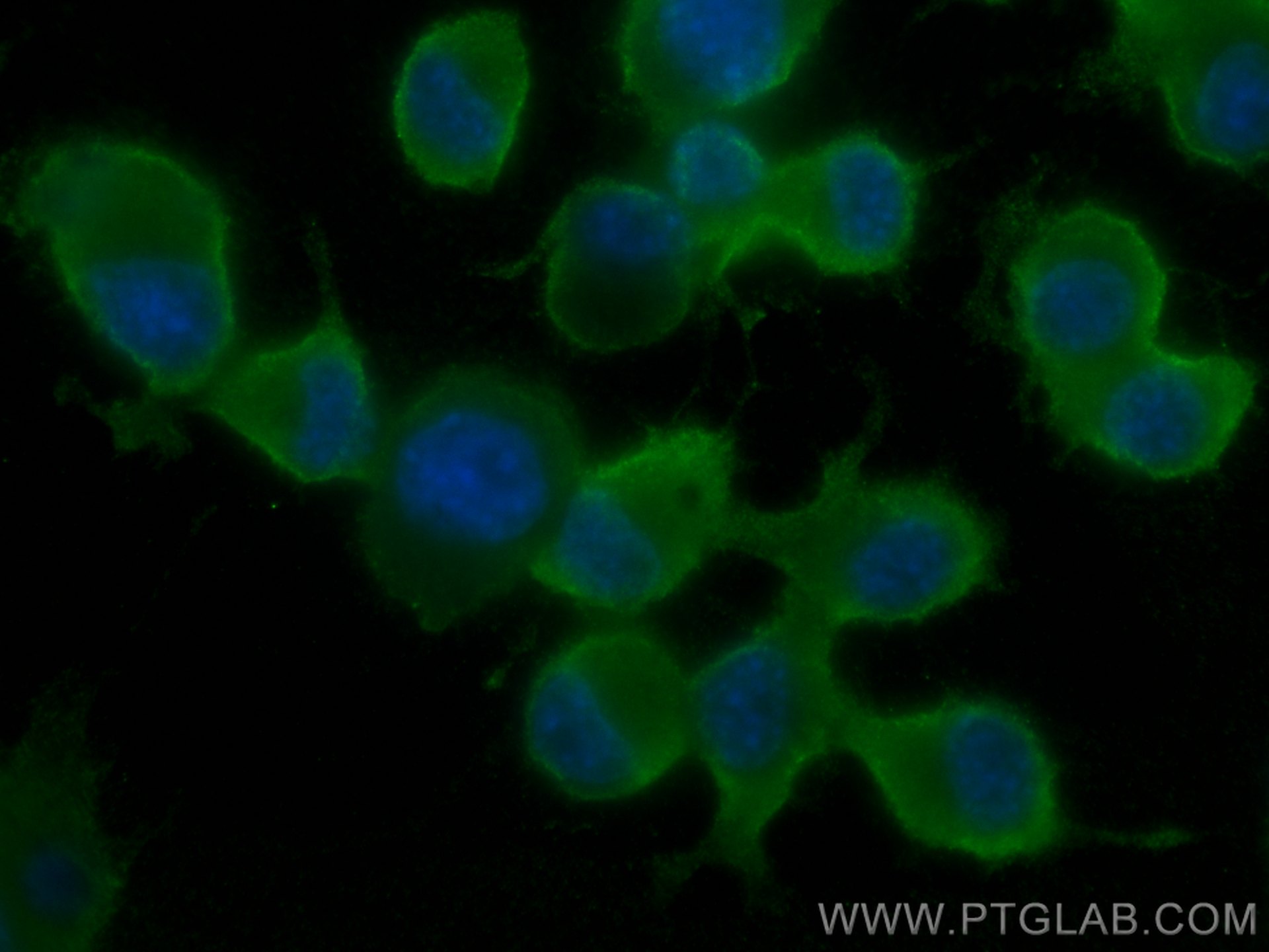 Immunofluorescence (IF) / fluorescent staining of Neuro-2a cells using CoraLite® Plus 488-conjugated Chromogranin A Monoc (CL488-60135)