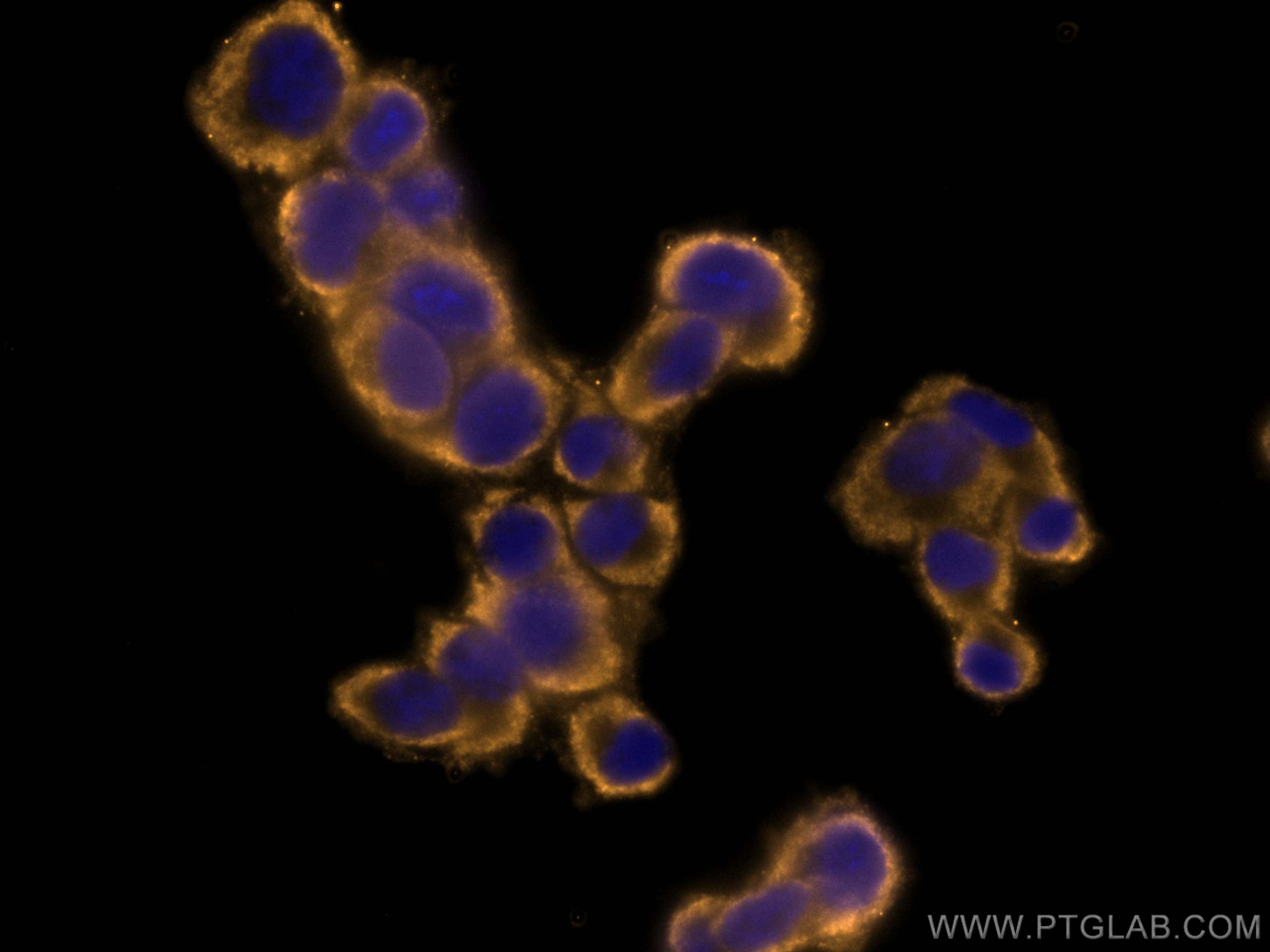 Immunofluorescence (IF) / fluorescent staining of PC-12 cells using CoraLite®555-conjugated Chromogranin A Monoclonal  (CL555-60135)