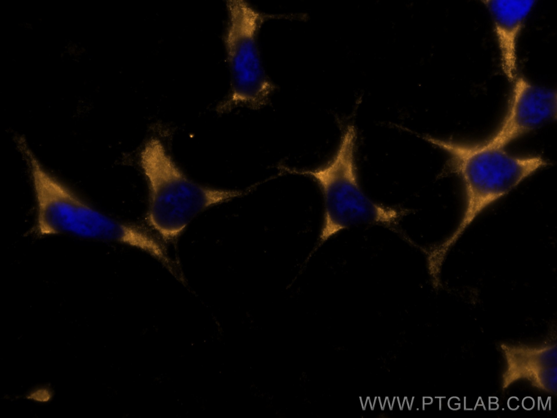 Immunofluorescence (IF) / fluorescent staining of SH-SY5Y cells using CoraLite®555-conjugated Chromogranin A Monoclonal  (CL555-60135)