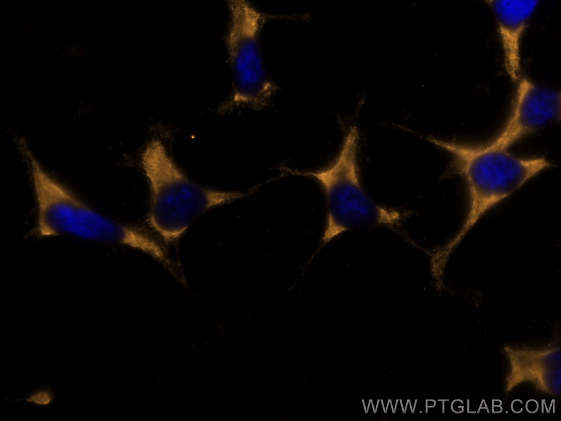 IF Staining of SH-SY5Y using CL555-60135