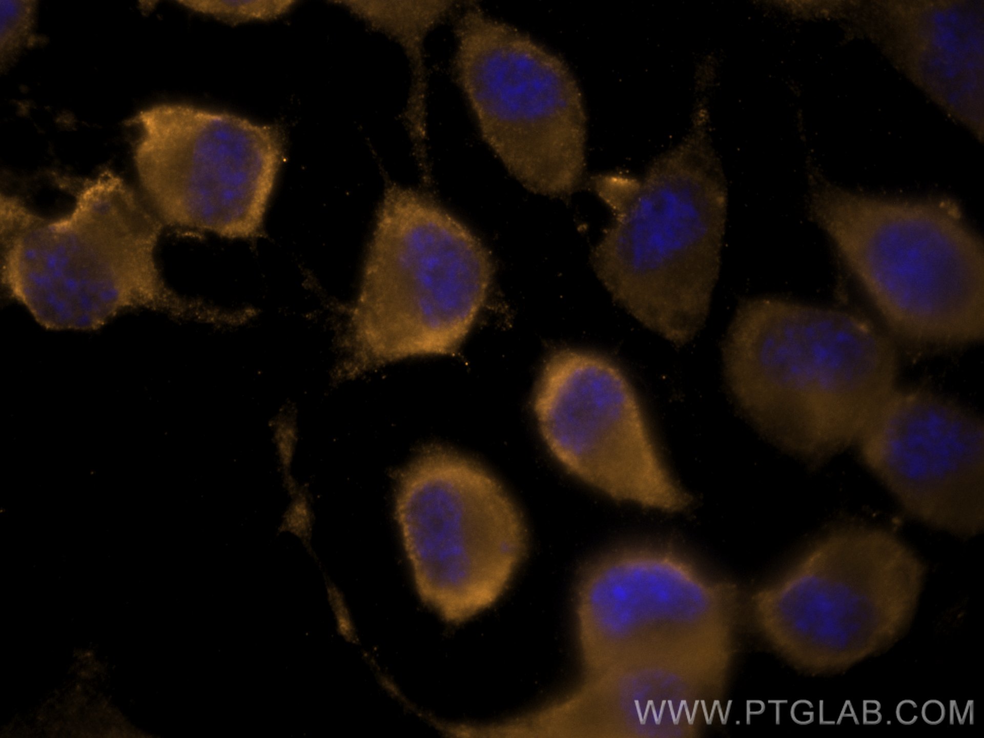 Immunofluorescence (IF) / fluorescent staining of Neuro-2a cells using CoraLite®555-conjugated Chromogranin A Monoclonal  (CL555-60135)