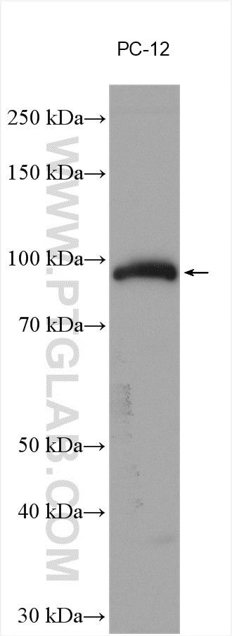 Western Blot (WB) analysis of various lysates using Chromogranin B Polyclonal antibody (28663-1-AP)