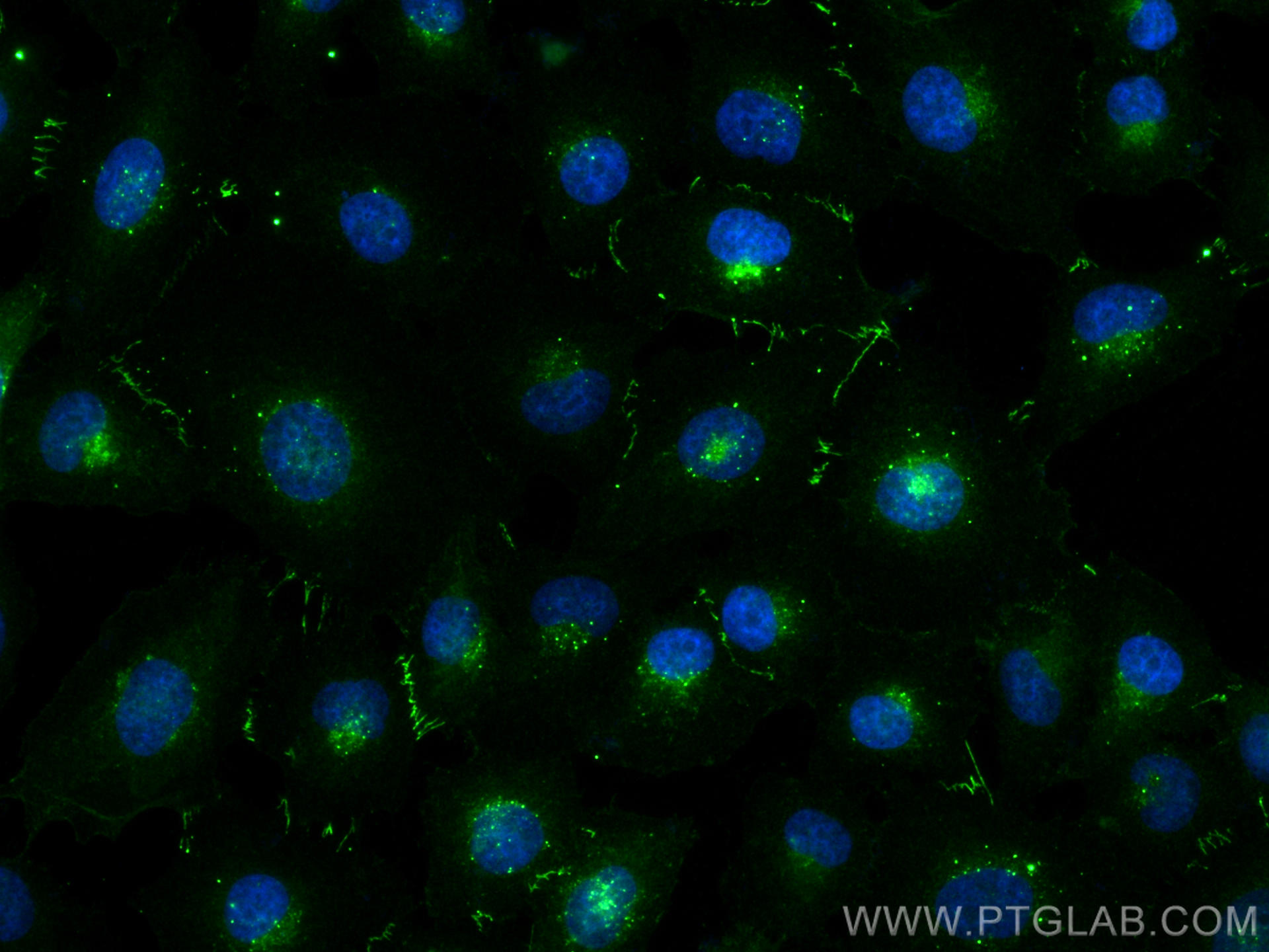 Immunofluorescence (IF) / fluorescent staining of HUVEC cells using Claudin 1 Polyclonal antibody (28674-1-AP)