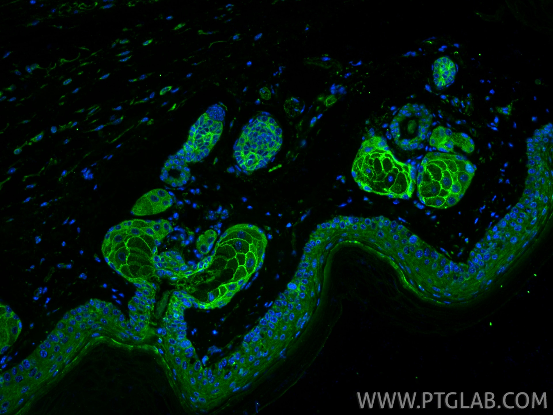 Immunofluorescence (IF) / fluorescent staining of mouse skin tissue using Claudin 1 Polyclonal antibody (28674-1-AP)