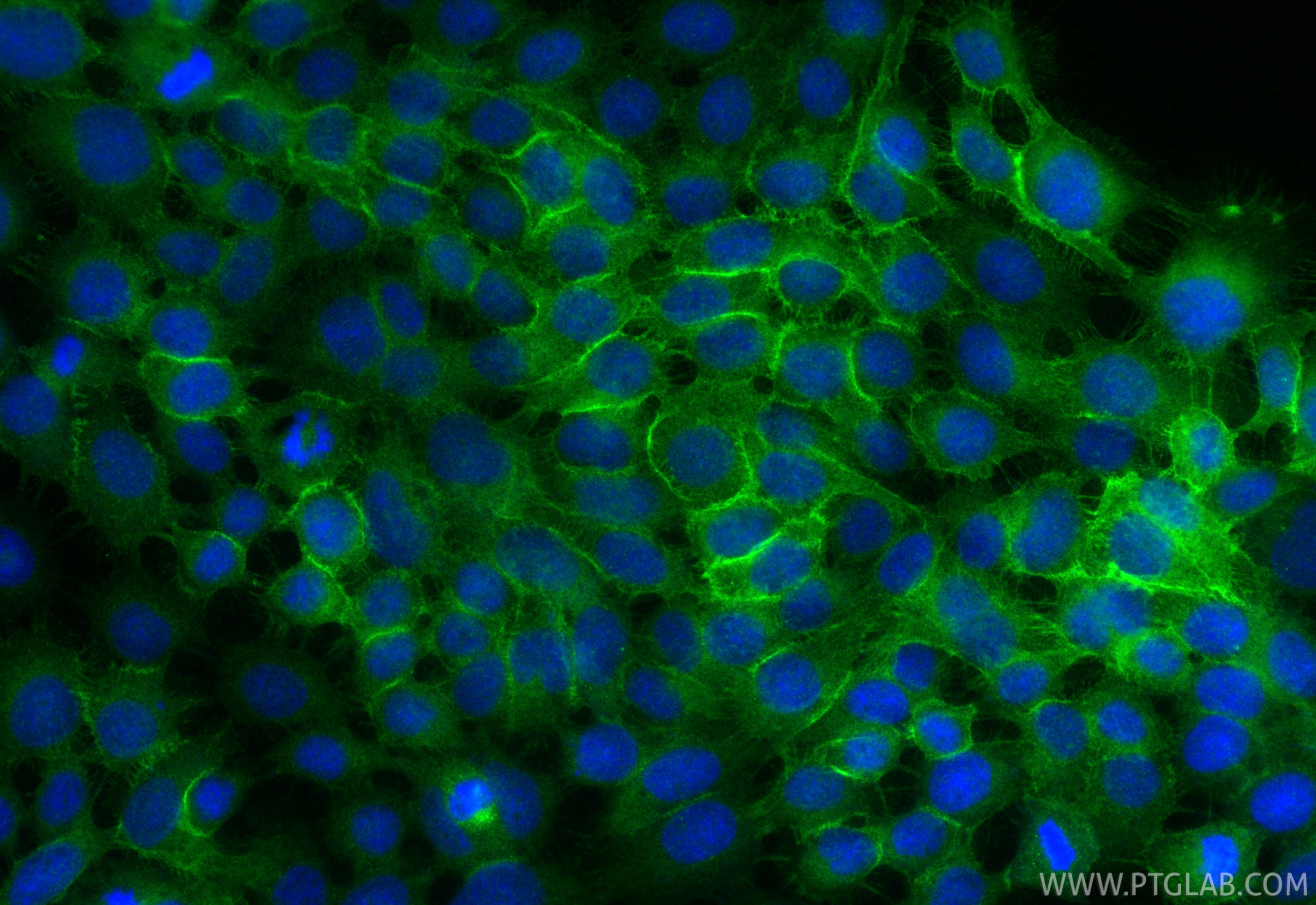 IF Staining of A431 using 28674-1-AP Immunofluorescence (IF) / fluorescent staining of A431 cells using Claudin 1 Polyclonal antibody (28674-1-AP)