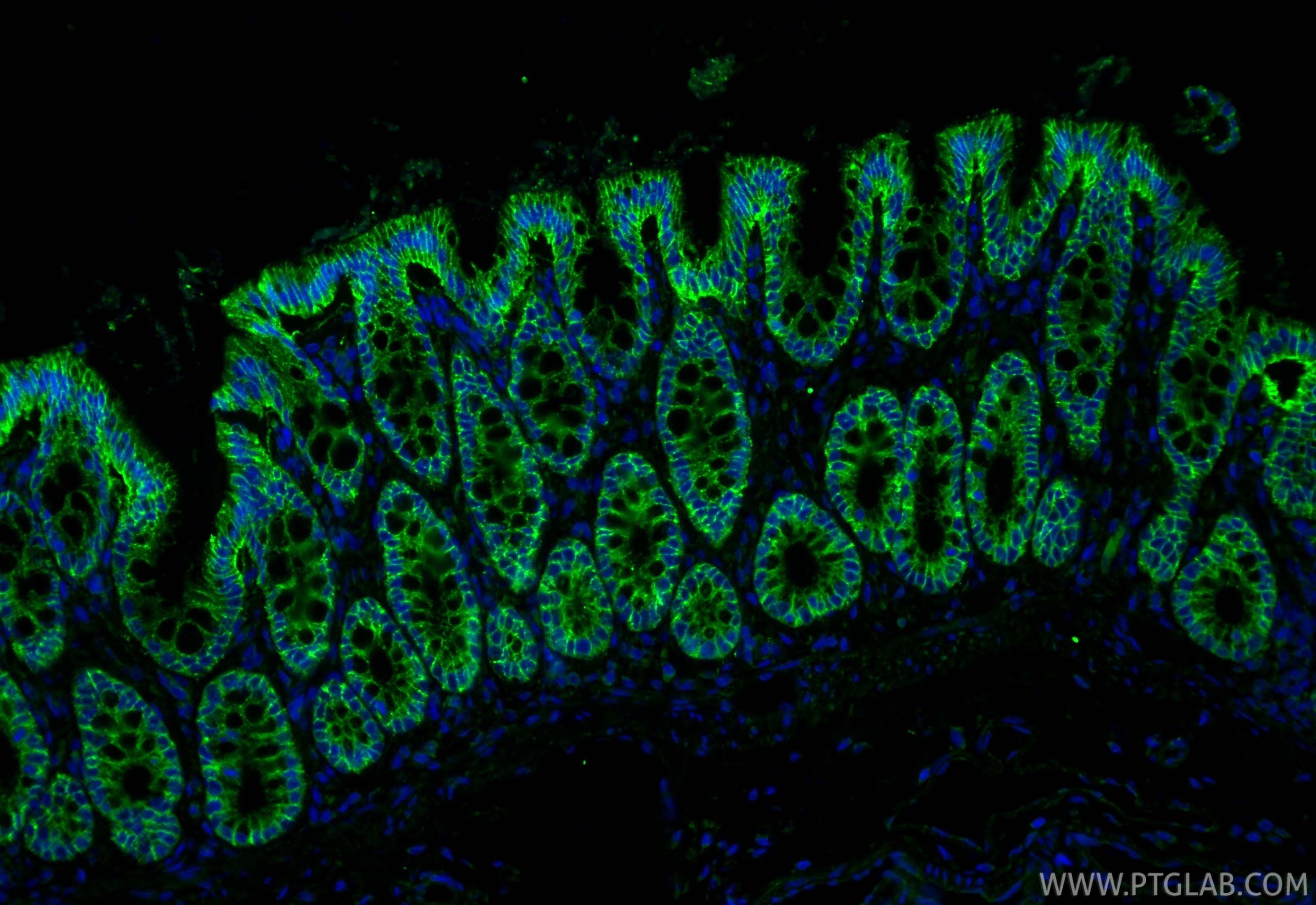 IF Staining of rat colon using 28674-1-AP Immunofluorescence (IF) / fluorescent staining of rat colon tissue using Claudin 1 Polyclonal antibody (28674-1-AP)