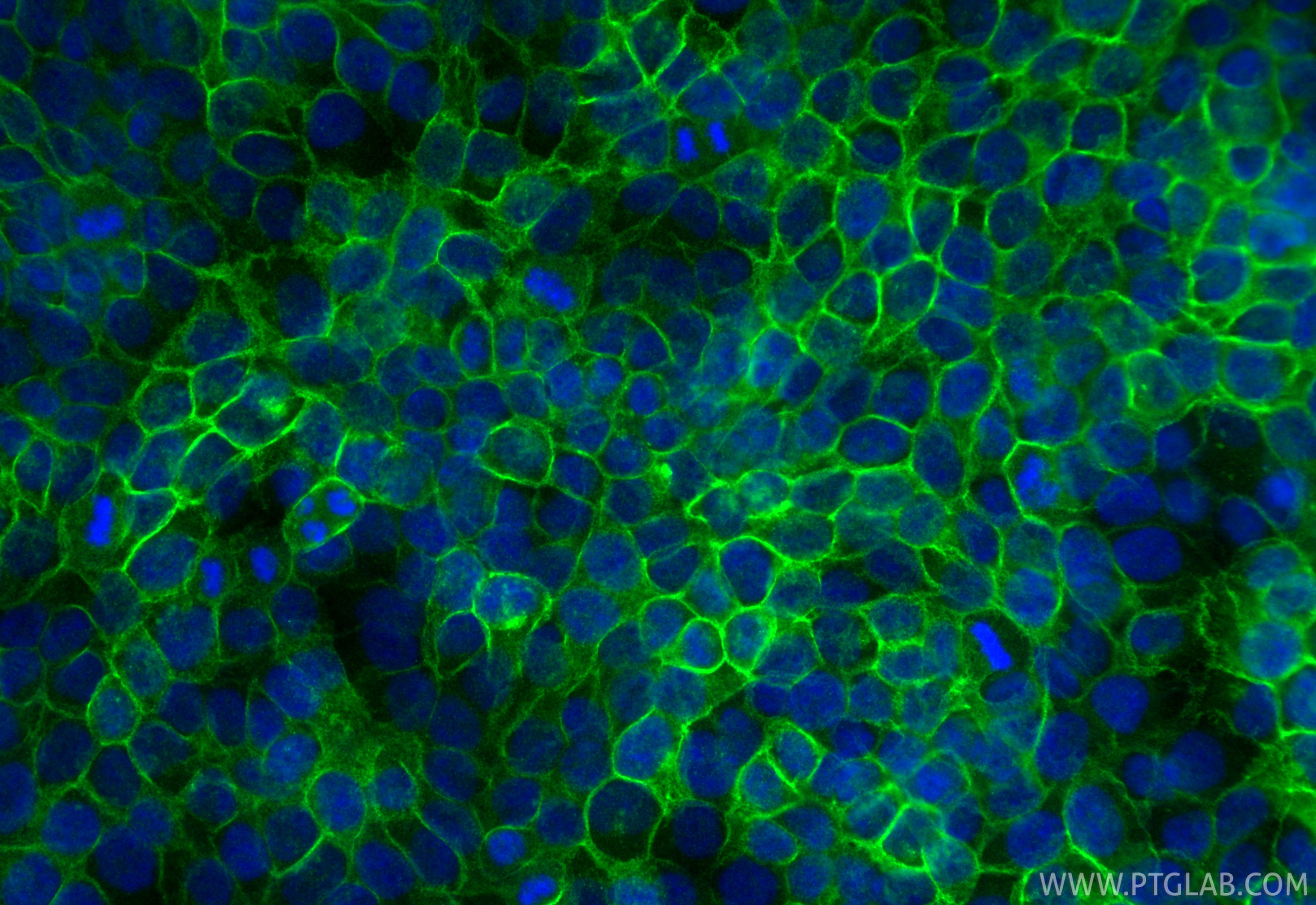 IF Staining of HaCaT using 28674-1-AP Immunofluorescence (IF) / fluorescent staining of HaCaT cells using Claudin 1 Polyclonal antibody (28674-1-AP)