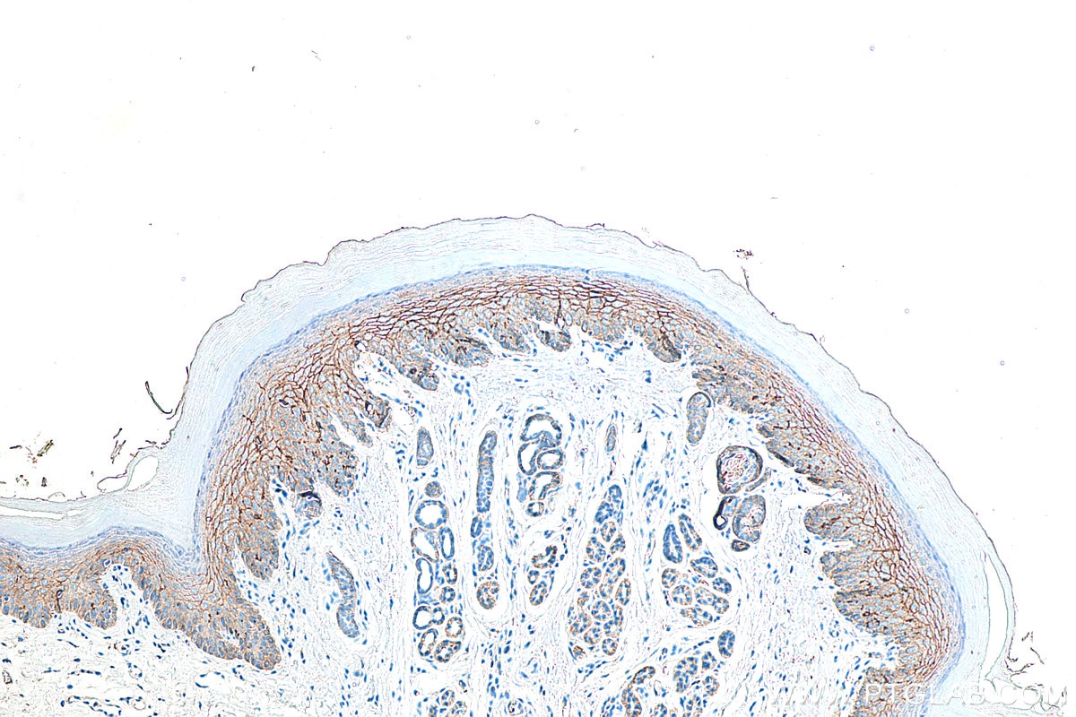 Immunohistochemistry (IHC) staining of mouse skin tissue using Claudin 1 Polyclonal antibody (28674-1-AP)