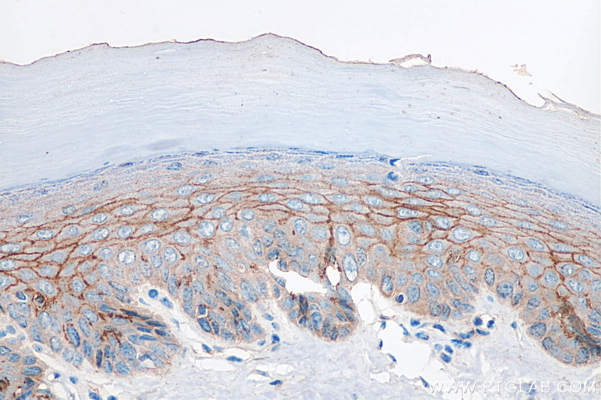 Immunohistochemistry (IHC) staining of mouse skin tissue using Claudin 1 Polyclonal antibody (28674-1-AP)