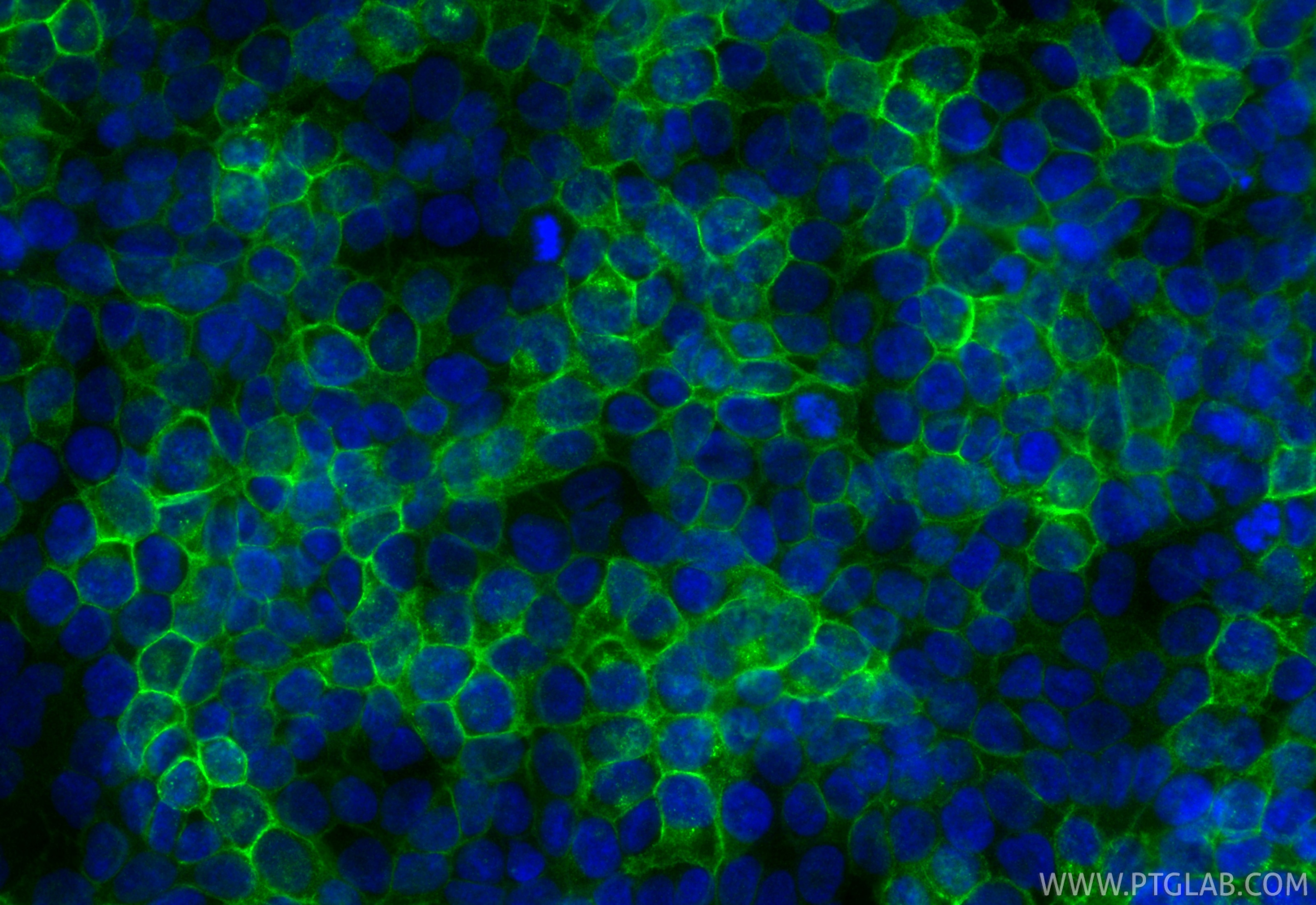 IF Staining of HaCaT using 68969-4-Ig Immunofluorescence (IF) / fluorescent staining of HaCaT cells using Claudin 1 Monoclonal antibody (68969-4-Ig)