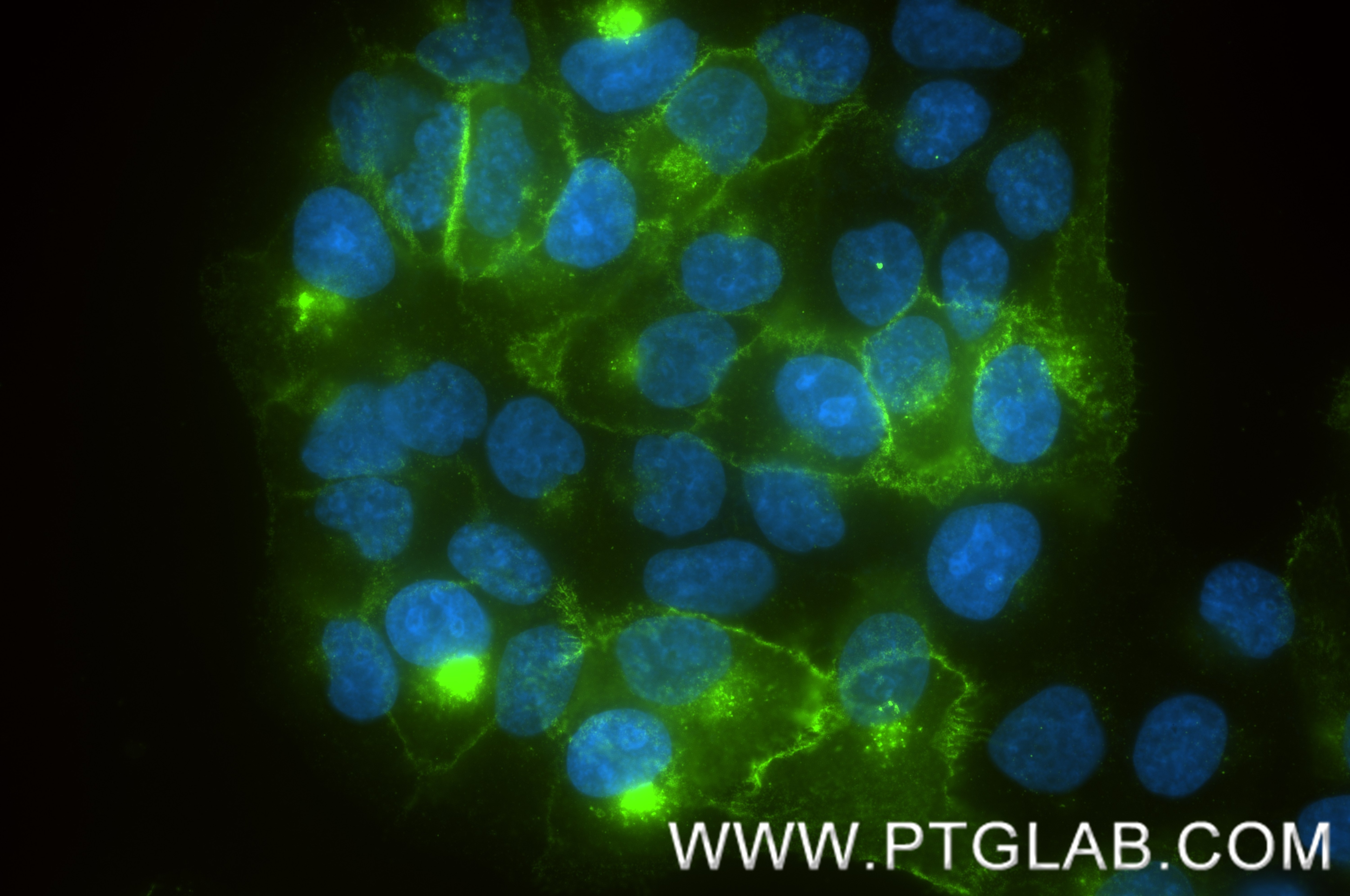 Immunofluorescence (IF) / fluorescent staining of HaCaT cells using Claudin 1 Recombinant monoclonal antibody (87782-2-RR)