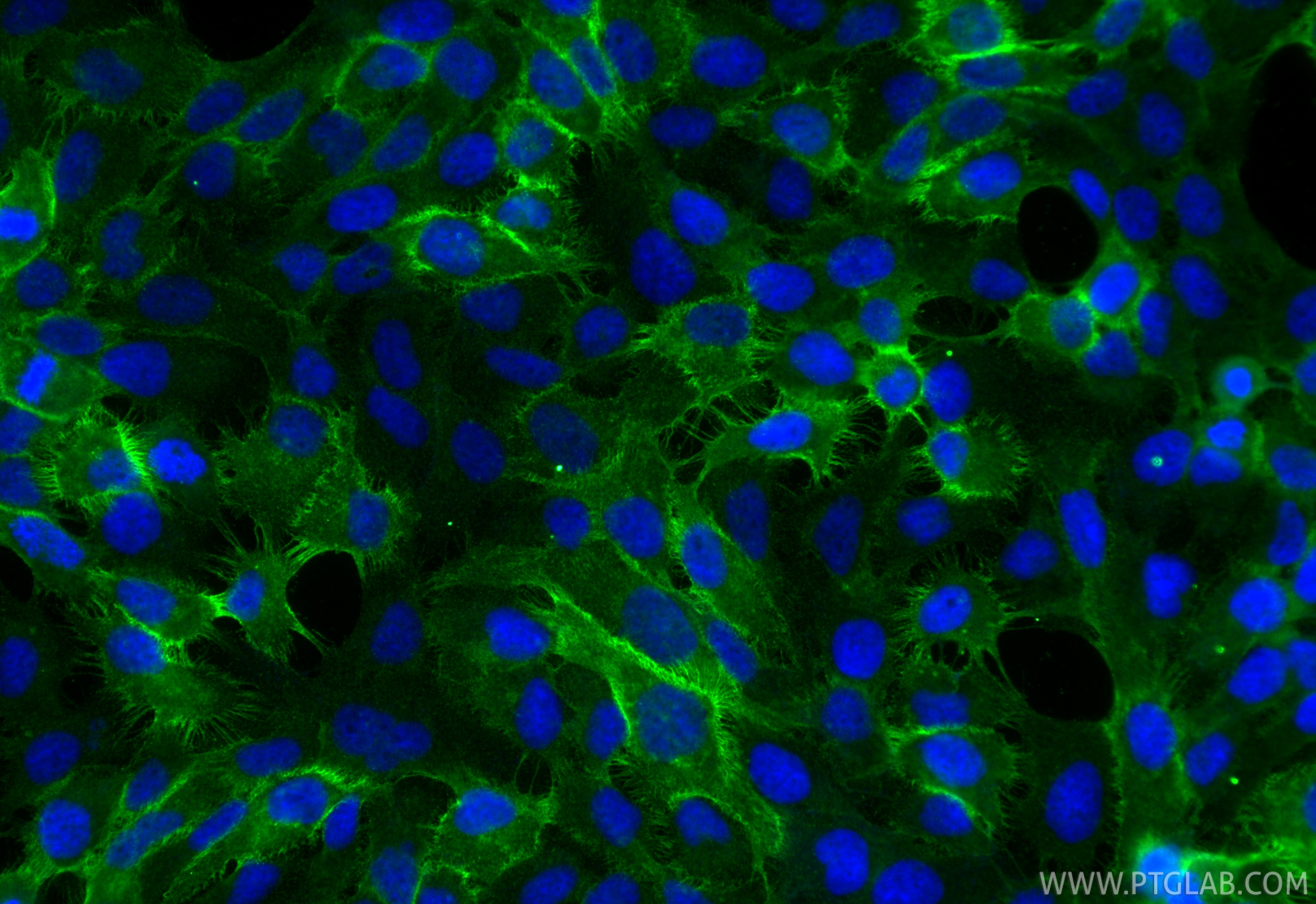 Immunofluorescence (IF) / fluorescent staining of HaCaT cells using Claudin 1 Recombinant monoclonal antibody (87782-2-RR)