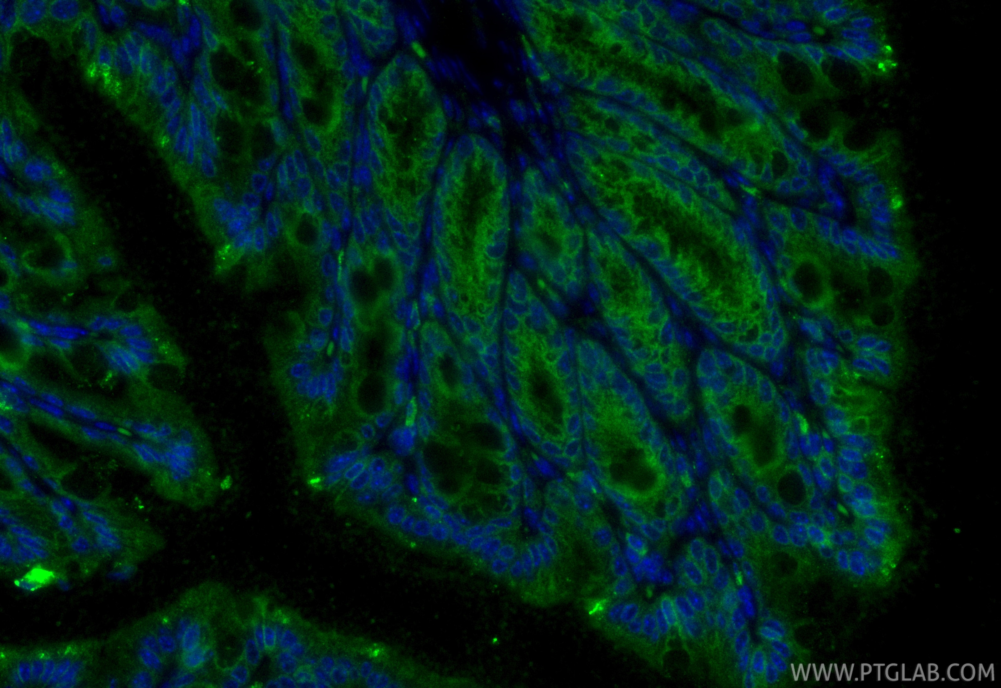 Immunofluorescence (IF) / fluorescent staining of mouse colon tissue using Claudin 1 Recombinant monoclonal antibody (87782-2-RR)