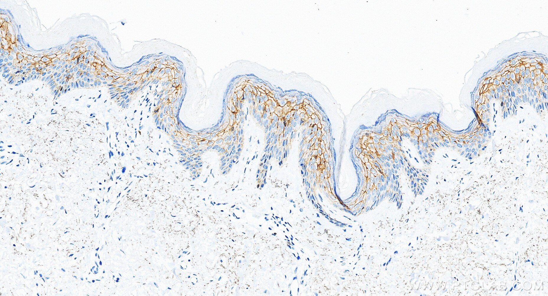 Immunohistochemistry (IHC) staining of human skin tissue using Claudin 1 Recombinant monoclonal antibody (87782-2-RR)