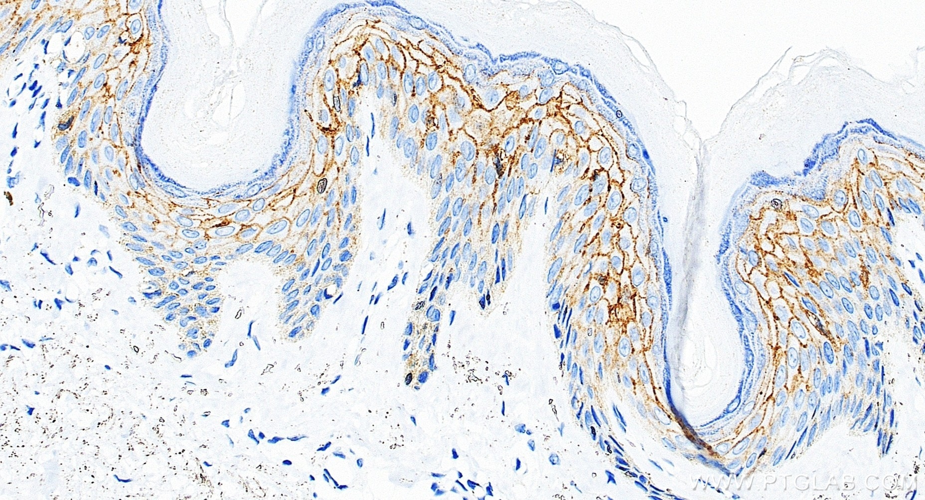 Immunohistochemistry (IHC) staining of human skin tissue using Claudin 1 Recombinant monoclonal antibody (87782-2-RR)